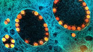 França identifica nova variante do coronavírus com mais de 40 mutações