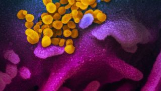 Internações por covid-19, favorecem o aumento de bactérias resistentes em UTIs