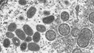 Brasil tem 17 casos confirmados para a varíola dos macacos, incluindo dois no estado do RS