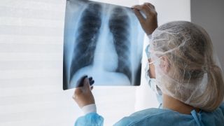 Projeto prevê incentivos a testes para diagnosticar a tuberculose
